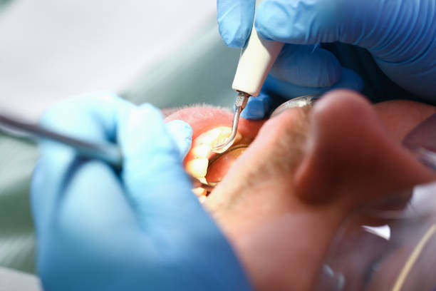 Best Cracked Tooth Emergency Dentist  in Florence, MS