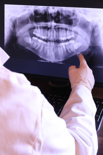 Tooth Infection Emergency Dentist in MS